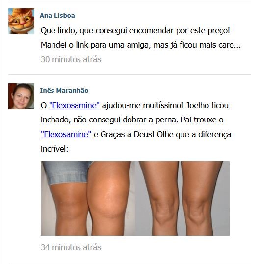 comentarios-flexosamine