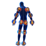 Dor nas Articulações​